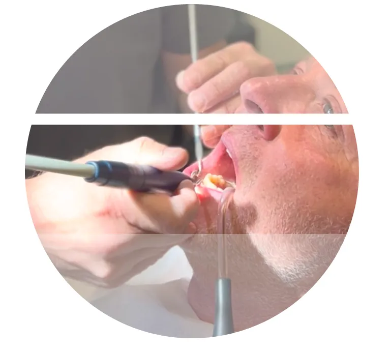 Close-up of a dental treatment procedure at Harajda Dent clinic